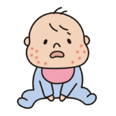 顔に湿疹ができた赤ちゃん