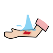 ケガを流水で流している腕