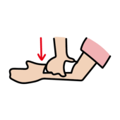 圧迫止血している腕