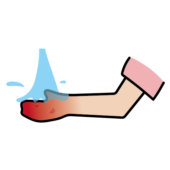 火傷を流水で冷やしている腕