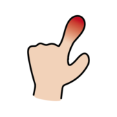 赤く腫れている指